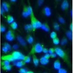 Glial Fibrillary Acidic Protein (GFAP) Antibody