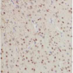 Glial Fibrillary Acidic Protein (GFAP) Antibody