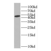 WB analysis of mouse brain tissue, using GFAP antibody (1/1000 dilution).