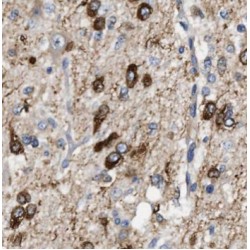 Glial Fibrillary Acidic Protein (GFAP) Antibody