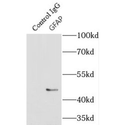 Glial Fibrillary Acidic Protein (GFAP) Antibody