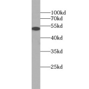 WB analysis of U-251 cells, using GFAP antibody (1/10000. dilution).