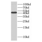 WB analysis of Jurkat cells, using GFOD2 antibody (1/500 dilution).