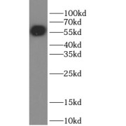 WB analysis of eGFP-tagged fusion protein, using GFP antibody (1/10000 dilution).