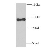 WB analysis of human skeletal muscle tissue, using GFPT1 antibody (1/1000 dilution).