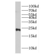 WB analysis of human brain tissue, using GGCT antibody (1/800 dilution).