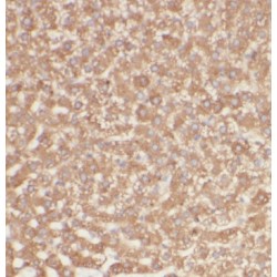 Gamma-Glutamyl Carboxylase (GGCX) Antibody