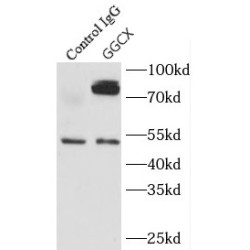 Gamma-Glutamyl Carboxylase (GGCX) Antibody