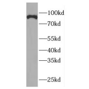 WB analysis of MCF7 cells, using GGCX antibody (1/2000 dilution).