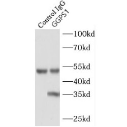 Geranylgeranyl Diphosphate Synthase 1 (GGPS1) Antibody