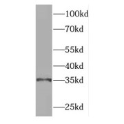 WB analysis of mouse brain tissue, using GGPS1 antibody (1/500 dilution).