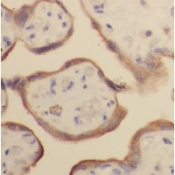 Growth Hormone Variant (GH2) Antibody