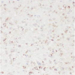 Growth Hormone Inducible Transmembrane Protein (GHITM) Antibody