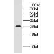 WB analysis of HeLa cells, using GHITM antibody (1/400 dilution).