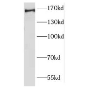 WB analysis of Jurkat cells, using GIGYF2 antibody (1/1000 dilution).