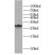 WB analysis of Jurkat cells, using GINS3 antibody (1/800 dilution).