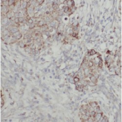 GIPC PDZ Domain Containing Family, Member 1 (GIPC1) Antibody