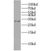WB analysis of mouse brain tissue, using GIYD2 antibody (1/600 dilution).