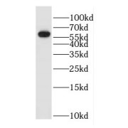 WB analysis of HeLa cells, using GK3P antibody (1/500 dilution).