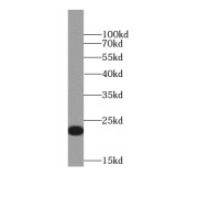 WB analysis of human stomach tissue, using GKN1 antibody (1/20000 dilution).