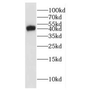 WB analysis of Jurkat cells, using GLI4 antibody (1/600 dilution).