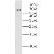 WB analysis of Jurkat cells, using GLIS1 antibody (1/300 dilution).