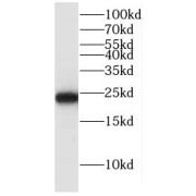 WB analysis of HepG2 cells, using GLO1 antibody (1/1000 dilution).