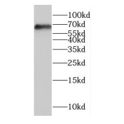 WB analysis of SH-SY5Y cells, using GLT25D2 antibody (1/600 dilution).