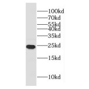 WB analysis of mouse brain tissue, using GLTP antibody (1/1000 dilution).