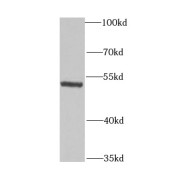 WB analysis of HeLa cells, using GLUD1 antibody (1/1000 dilution).