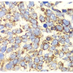 Glutamate Dehydrogenase 2, Mitochondrial (GLUD2) Antibody