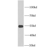 WB analysis of mouse brain tissue, using GLUD2 antibody (1/1000 dilution).