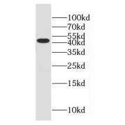 WB analysis of rat liver tissue, using Glutamine synthetase antibody (1/600 dilution).