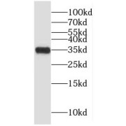 WB analysis of human liver tissue, using GLYATL1 antibody (1/500 dilution).