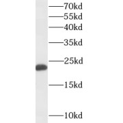 WB analysis of HeLa cells, using GM2A antibody (1/500 dilution).