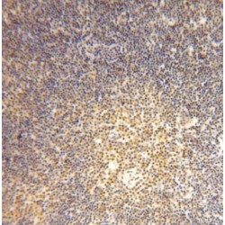 GDP-Mannose 4,6 Dehydratase (GMDS) Antibody