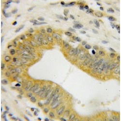 Glucocorticoid Modulatory Element Binding Protein 2 (GMEB2) Antibody