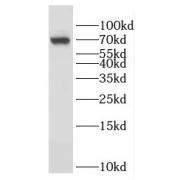 WB analysis of human placenta tissue, using GMEB2 antibody (1/300 dilution).