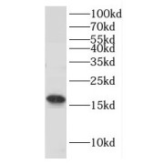 WB analysis of rat brain tissue, using GMFB antibody (1/500 dilution).