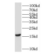 WB analysis of rat brain tissue, using GMFG antibody (1/600 dilution).