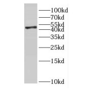 WB analysis of HEK-293 cells, using GMPPA antibody (1/1000 dilution).