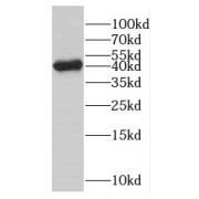 WB analysis of mouse brain tissue, using GMPPB antibody (1/1000 dilution).