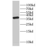 WB analysis of mouse skin tissue, using GMPR antibody (1/500 dilution).