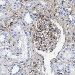 Guanine Nucleotide Binding Protein Subunit Alpha-14 (GNA14) Antibody