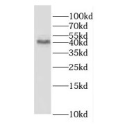 WB analysis of mouse lung tissue, using GNA14 antibody (1/600 dilution).