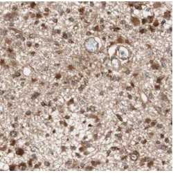 Guanine Nucleotide Binding Protein (G Protein), Alpha Inhibiting Activity Polypeptide 1 (GNAI1) Antibody