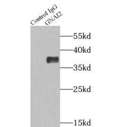 Guanine Nucleotide Binding Protein (G Protein), Alpha Inhibiting Activity Polypeptide 2 (GNAI2) Antibody