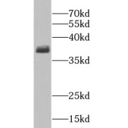 WB analysis of human brain tissue, using GNAI2 antibody (1/800 dilution).