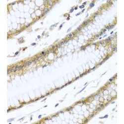 Guanine Nucleotide Binding Protein (G Protein), Alpha Inhibiting Activity Polypeptide 3 (GNAI3) Antibody