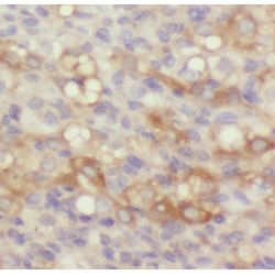 Guanine Nucleotide Binding Protein (G Protein), Beta Polypeptide 2 (GNB2) Antibody
